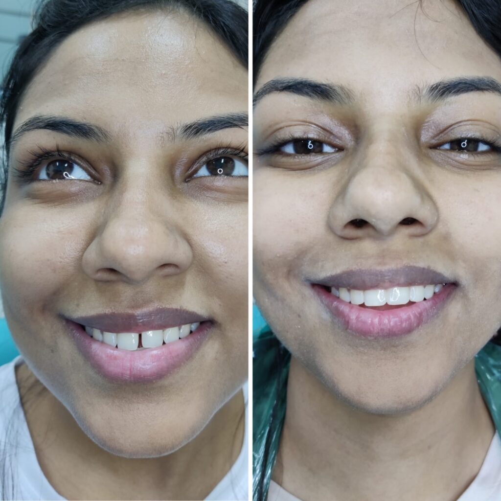 Dental services in goregaon east