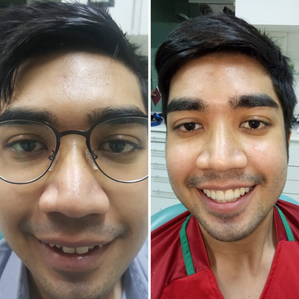 dentist in goregaon east