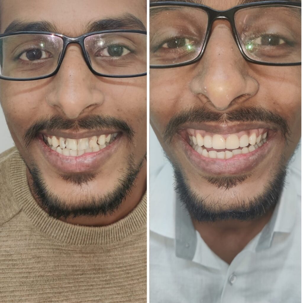 dental treatments in mumbai