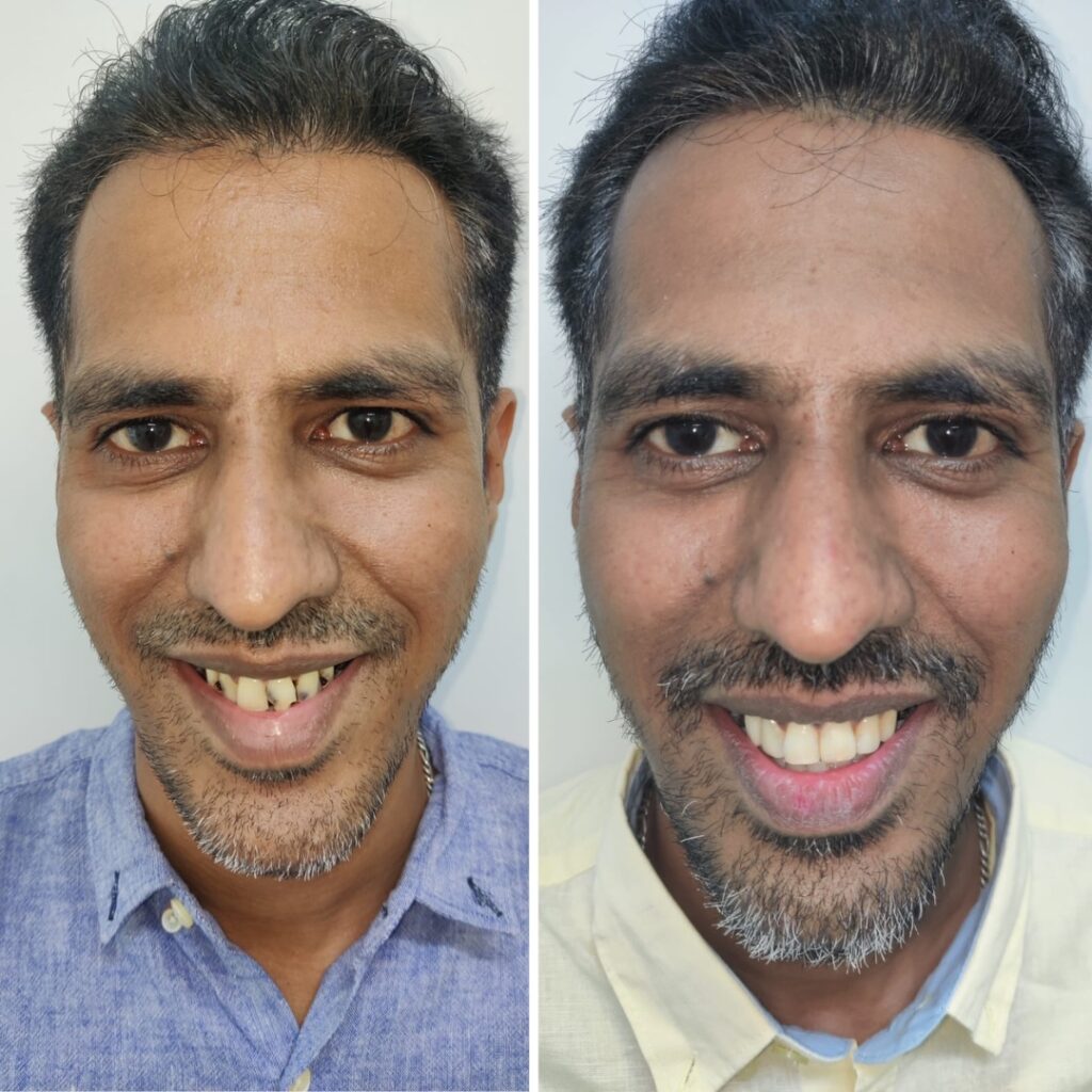dentist in mumbai