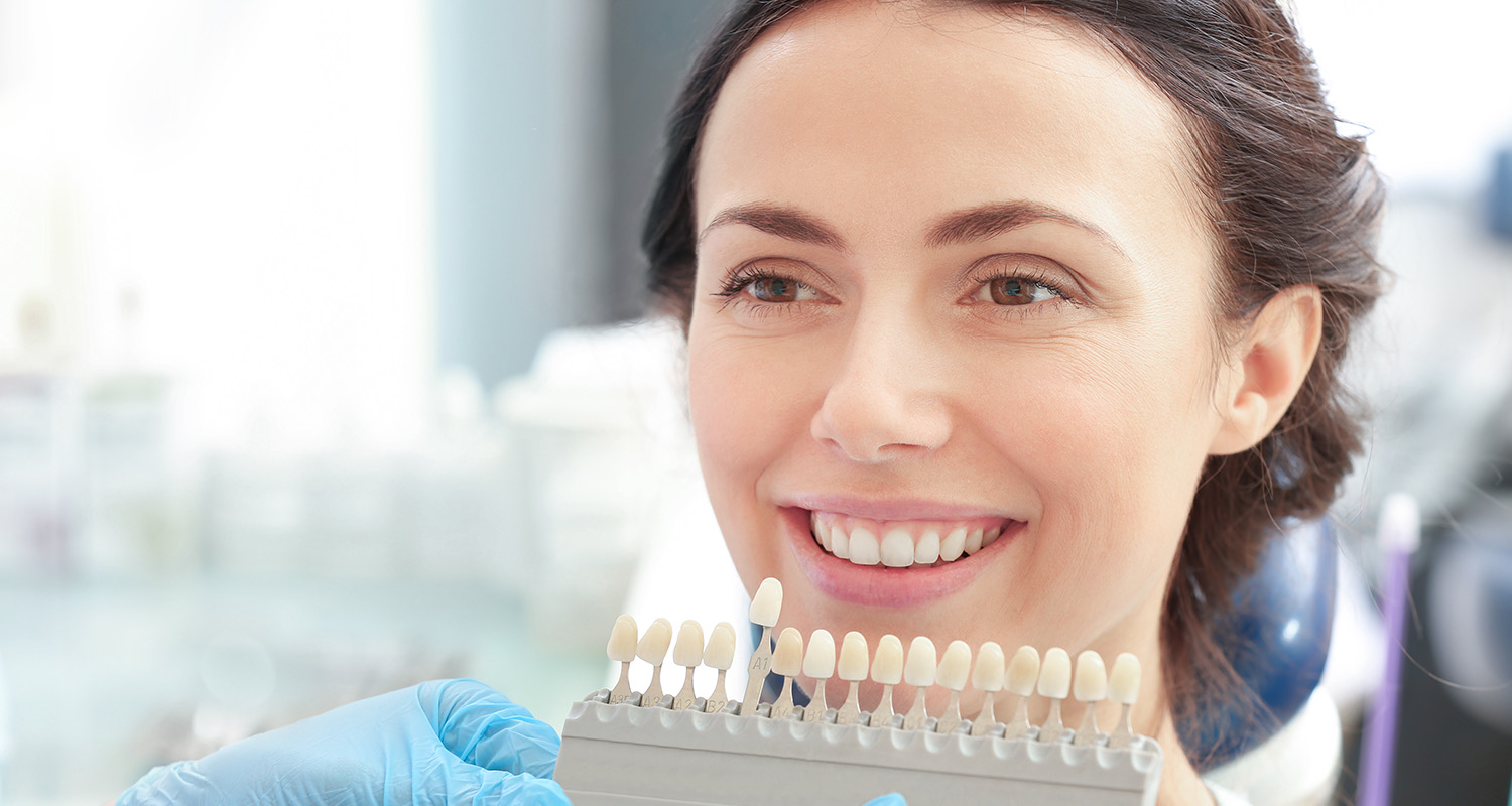 How Long Do Dental Veneers Last?