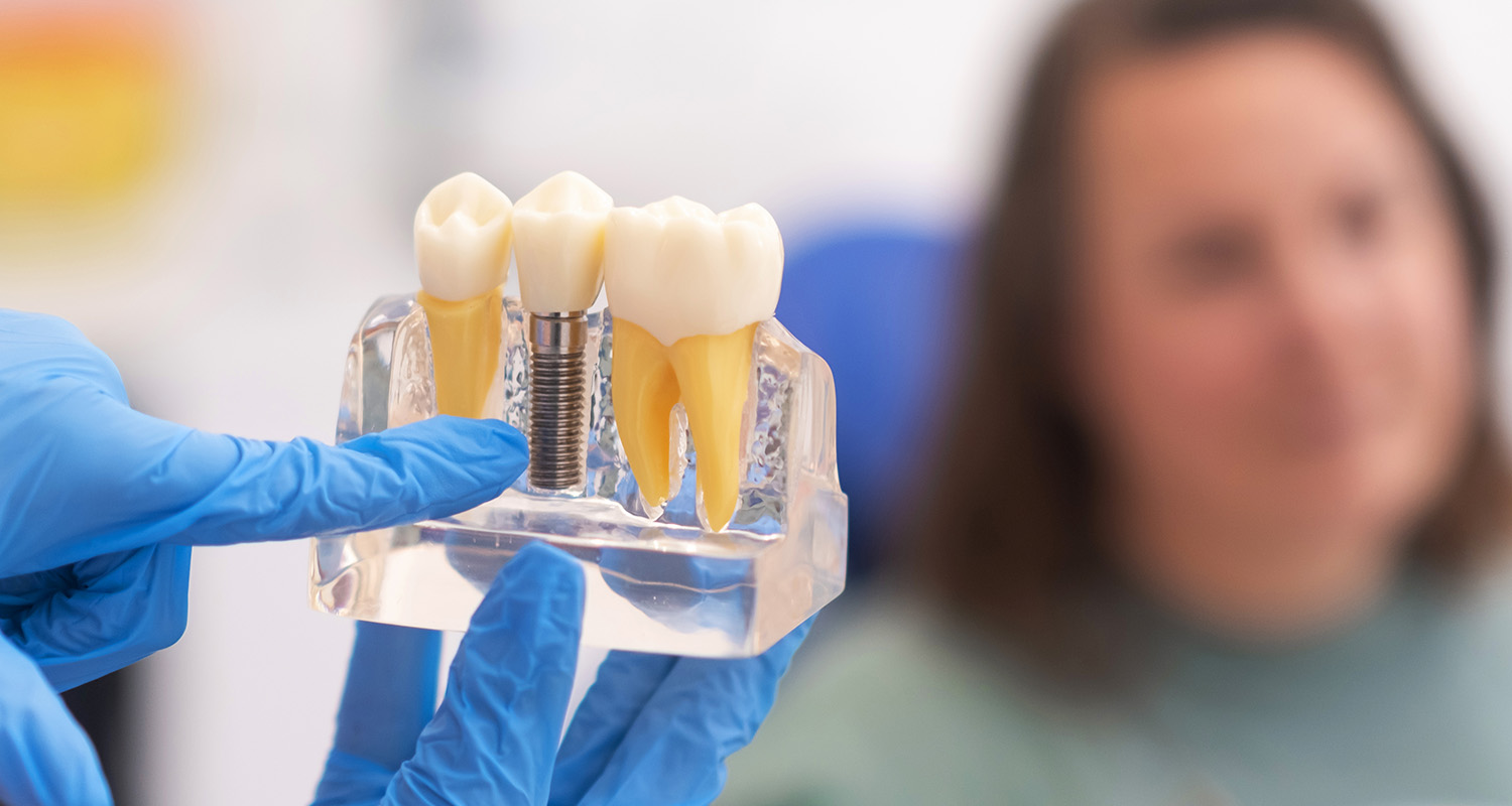 Are Dental Implants Painful? A Guide to Surgery and Recovery