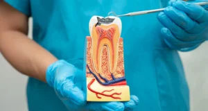 Do Root Canals Really Hurt? The Truth Your Dentist Won’t Sugar-Coat