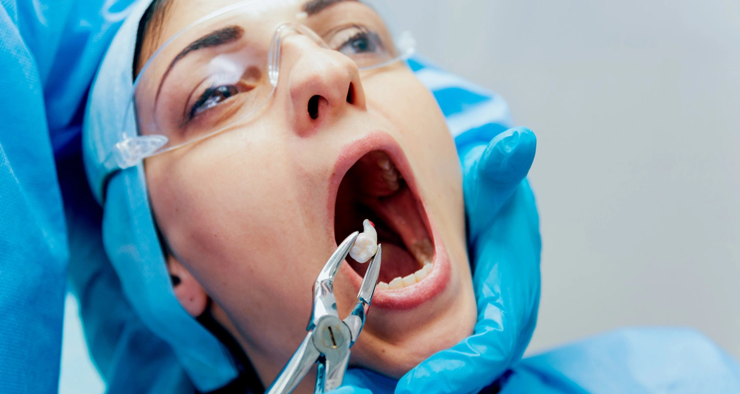 Root Canal vs Extraction: Which One Actually Saves Your Smile?
